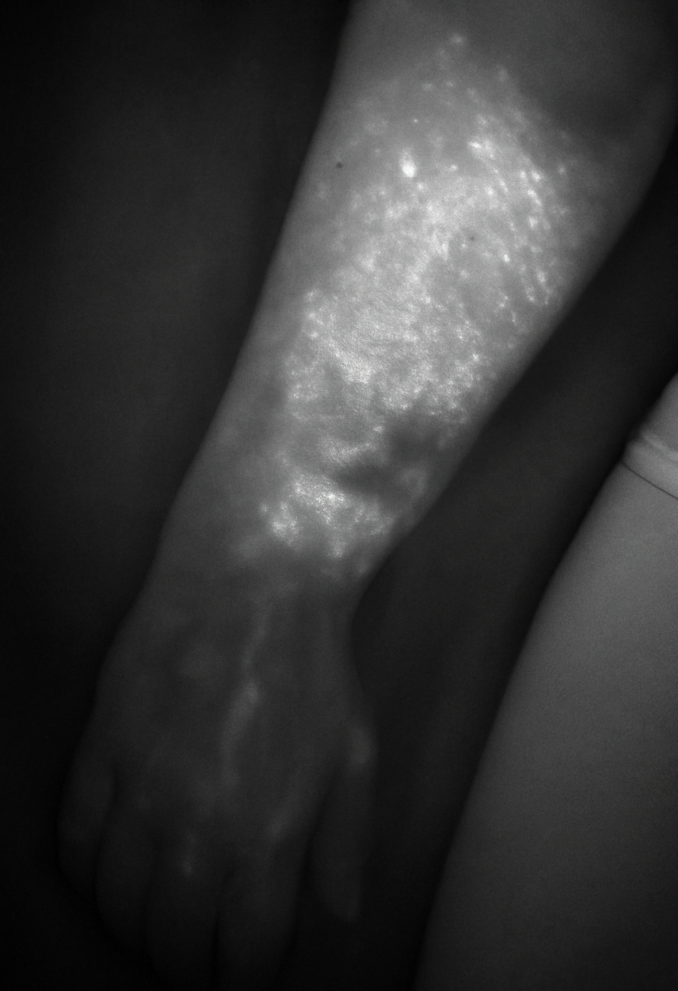 Lymph_Figure2.jpg