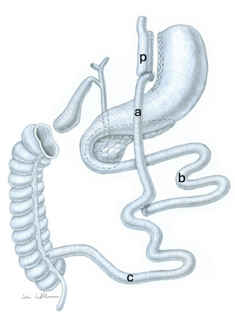limb length_fig.2.png