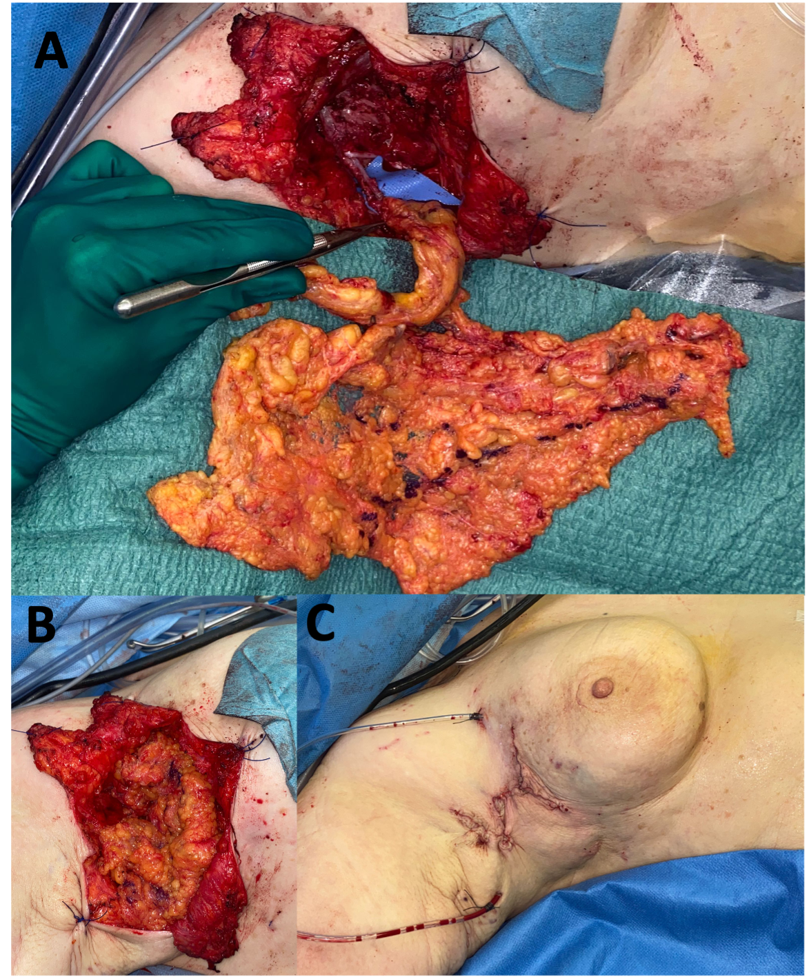 Lymph_Figure6.png