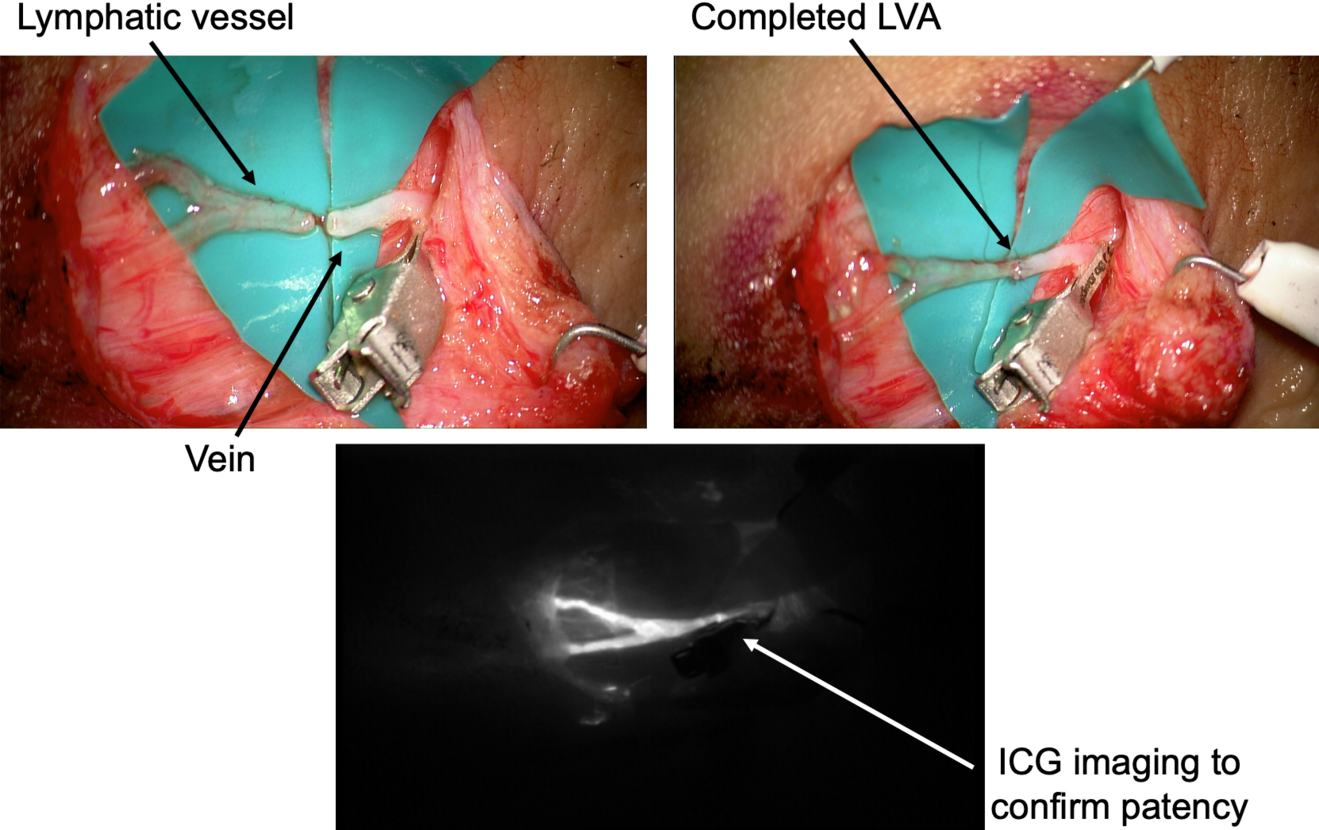 Figure 2_LVA.png