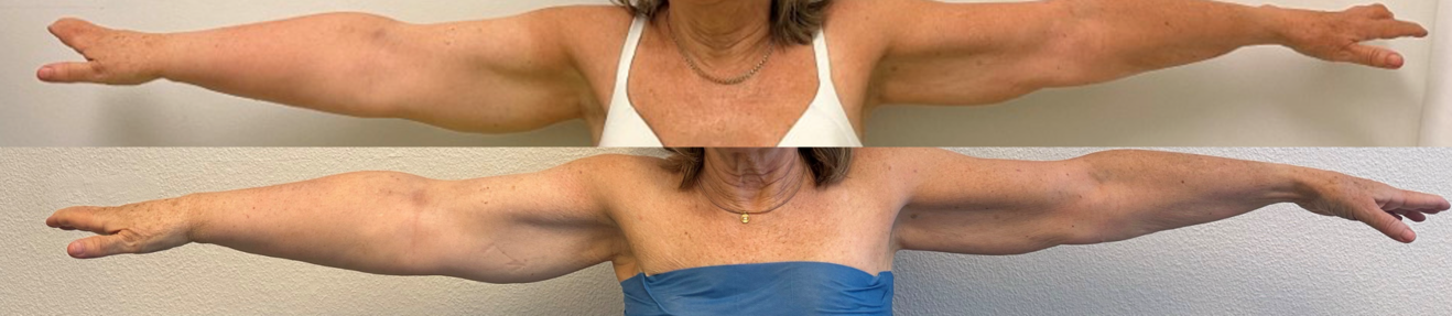 Lymph_Figure10.png