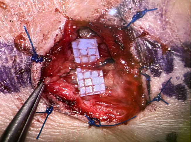 Lymph_Figure4.png