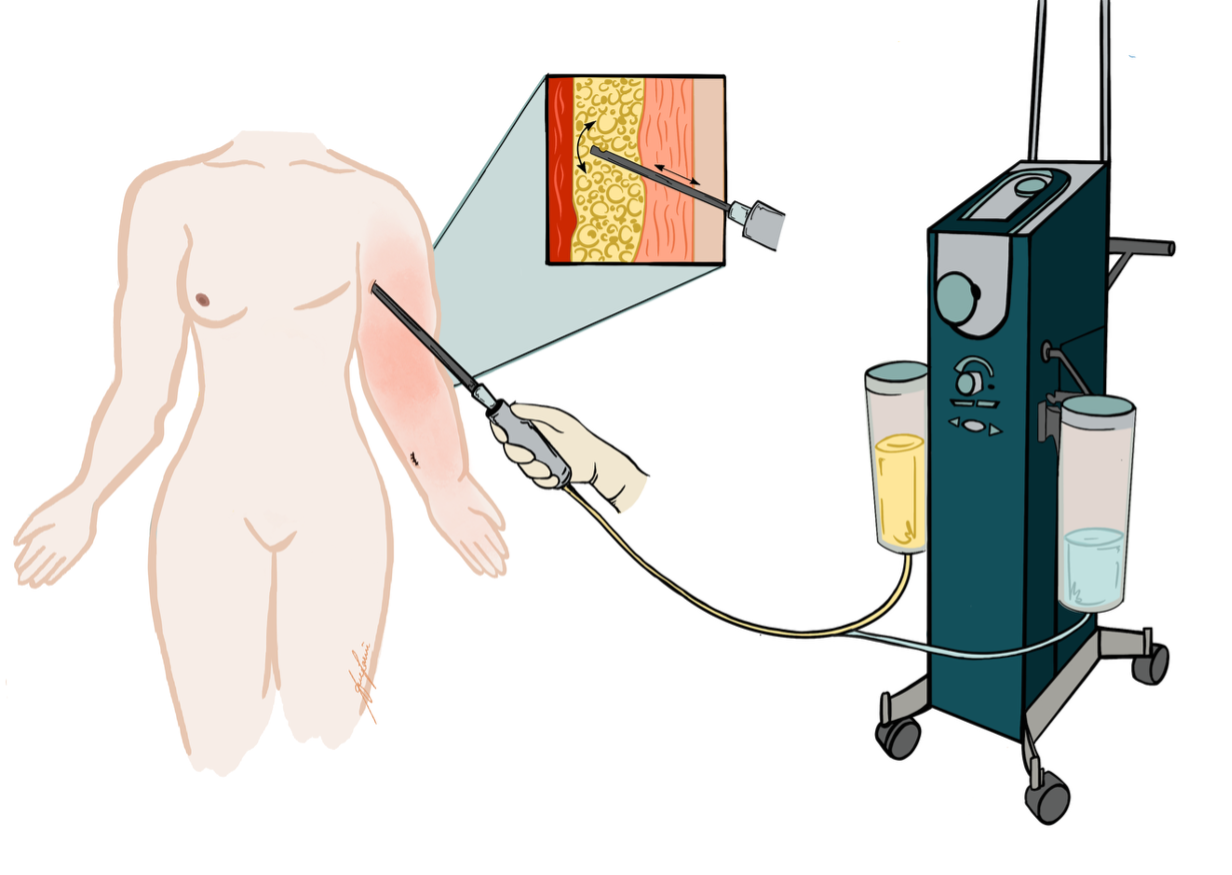 Lymph_Figure8.png