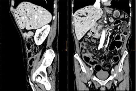 Whom to believe: discrepancy between image and clinical finding