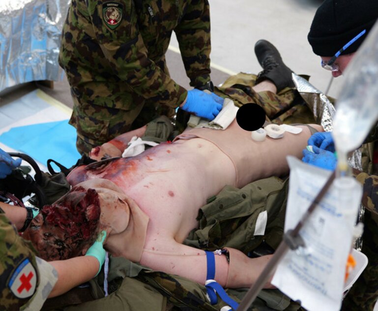 Emergency Management of Modern Combat Injuries
